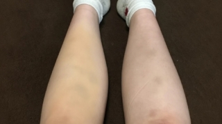 足が汚い